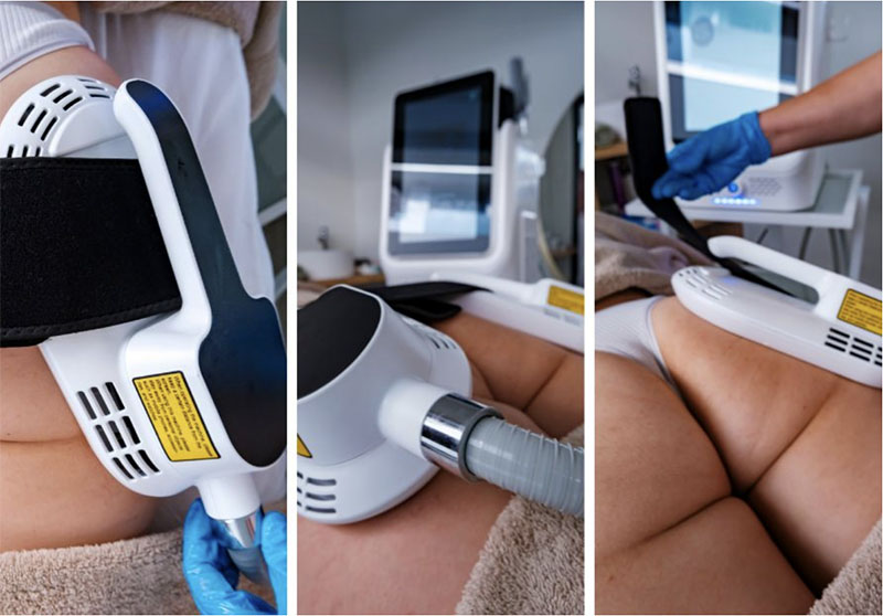 Electroestimulación en glúteos, la combinación perfecta