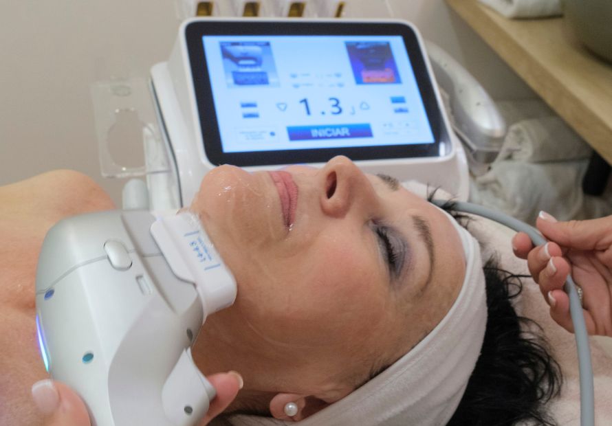 Consejos para prolongar los efectos del Hifu facial