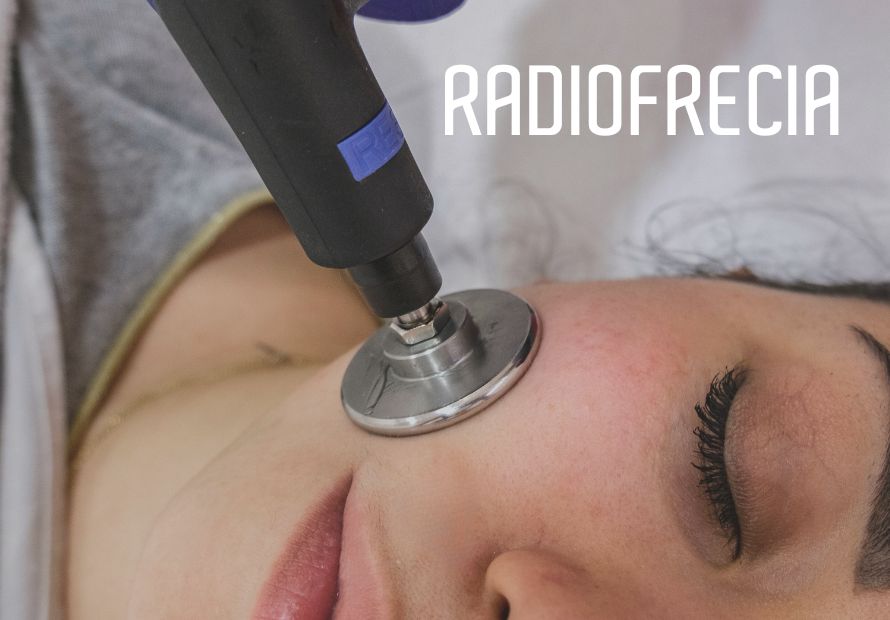 Radiofrecuencia
