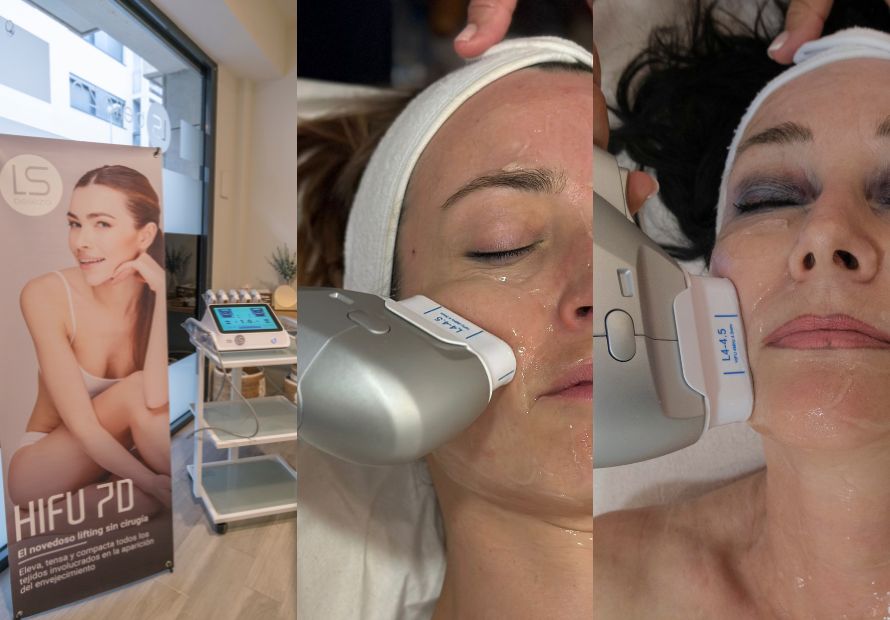 Hifu facial. Última tecnología para el rejuvenecimiento facial