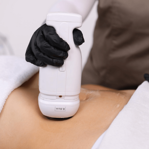 liposonix-abdomen