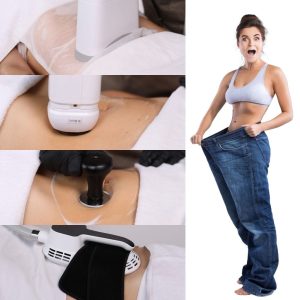 como -funciona-la-lipoescultura-sin-cirugia