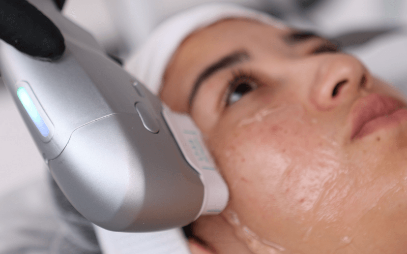 Con HIFU 7D, resultados superiores y duraderos Sin cirugía, sin tiempo de recuperación