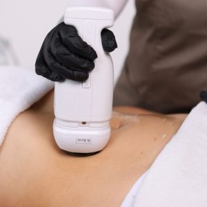 liposonix-ultrasonido-focalizado-para-resultados-inmediatos