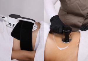 tecnologias-complementarias-que-potencia-la-lipoescultura-sin-cirugia