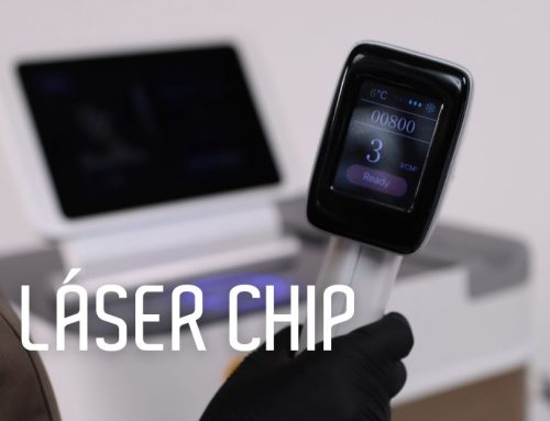 Descubre el Láser Chip de LS Belleza