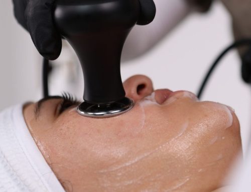 Radiofrecuencia facial para evitar la flacidez