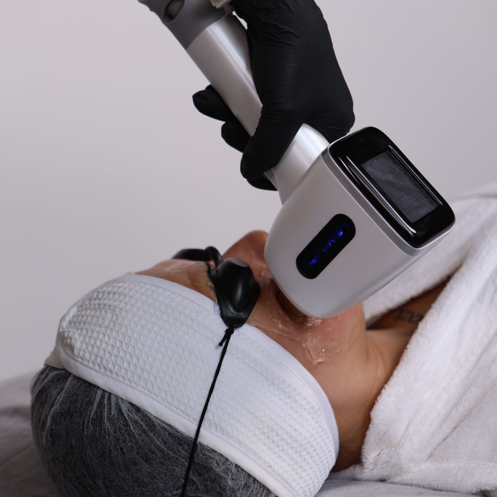 rejuvenecimiento-facial
